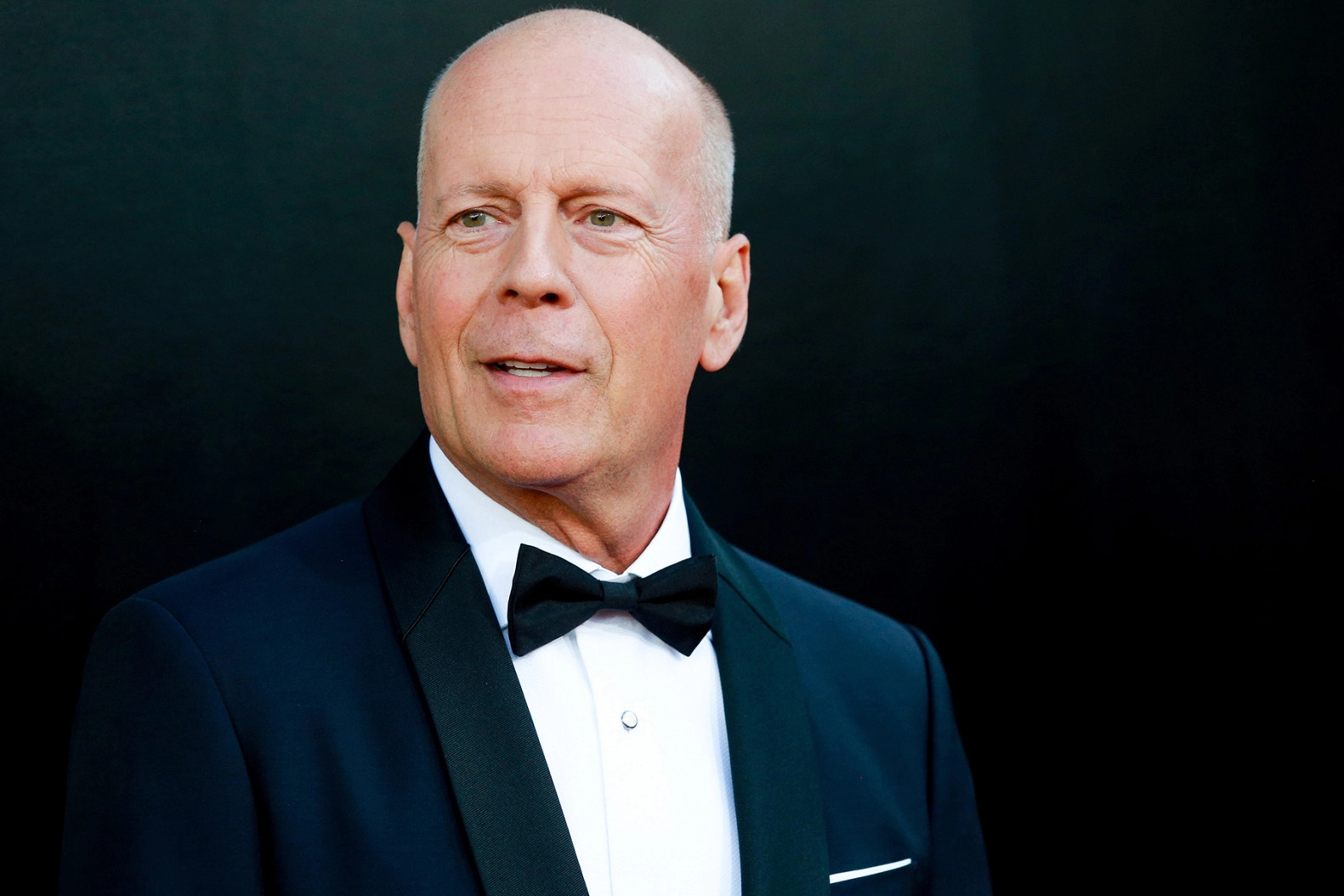 Bruce Willis‘ Frontotemporal Dementia Diagnosis Explained: A ’Heartbreaking’ Disease