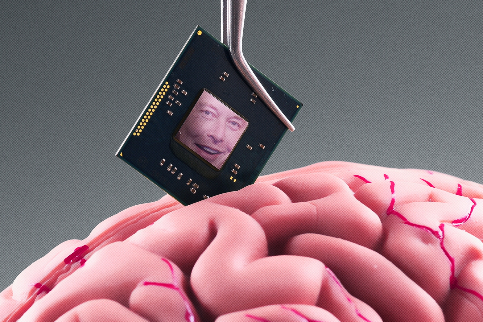 Meet the Folks Lining Up for Elon Musk’s Brain Implant